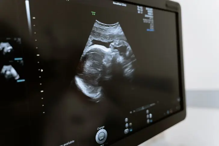 prenatal-vitamins-3